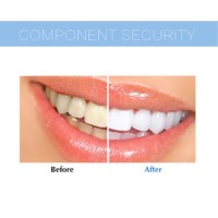 LED Teeth Whitening - General Store 44-General store-best selling products 2022